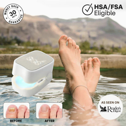 TRENDFOL™ - Nail Fungus Laser Device